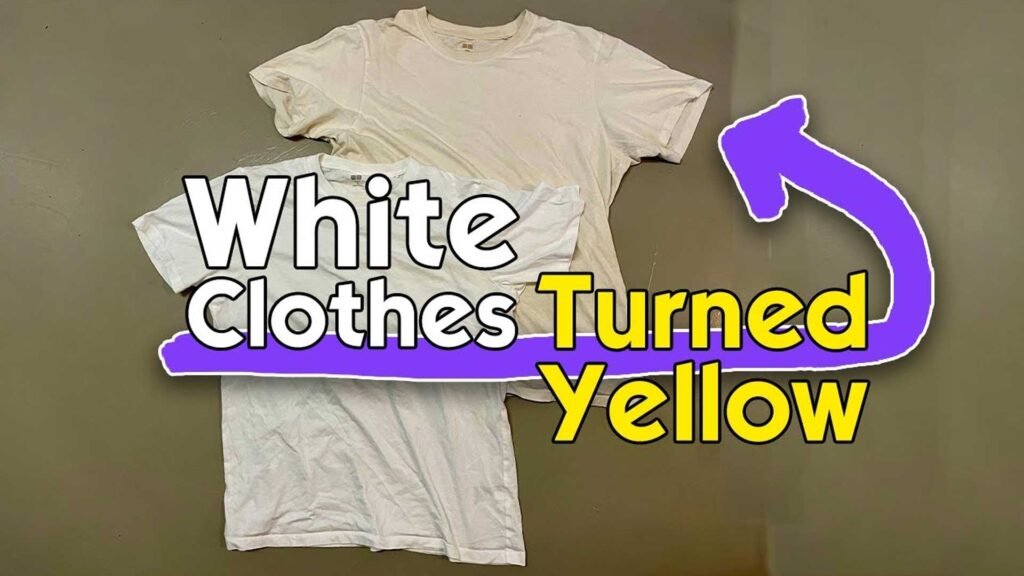 Why Do White Clothes Turn Yellow